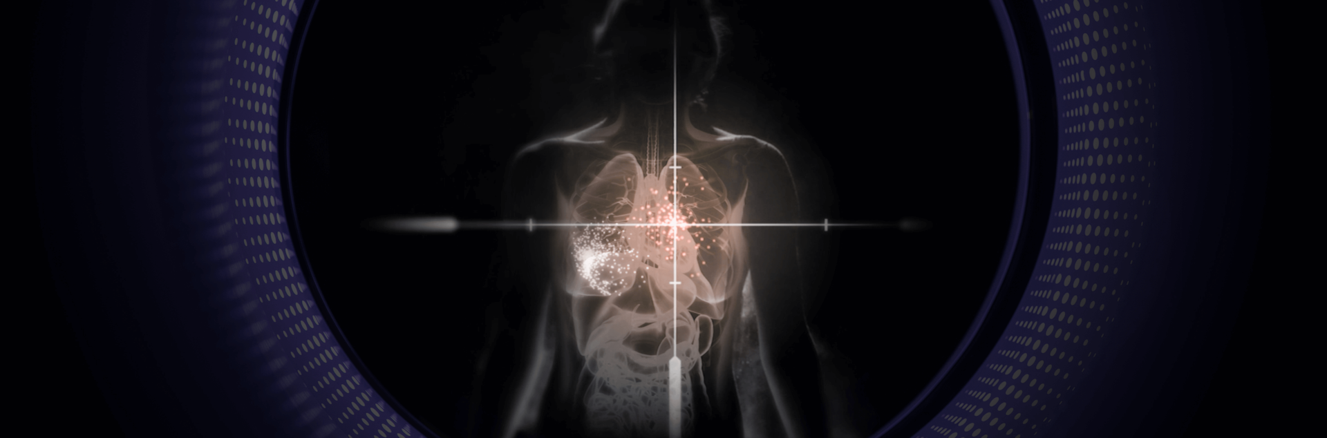The first high-resolution PET image of total-body CD8+ T-cell distribution after COVID-19 infection is done by UC Davis Project Scientist.
