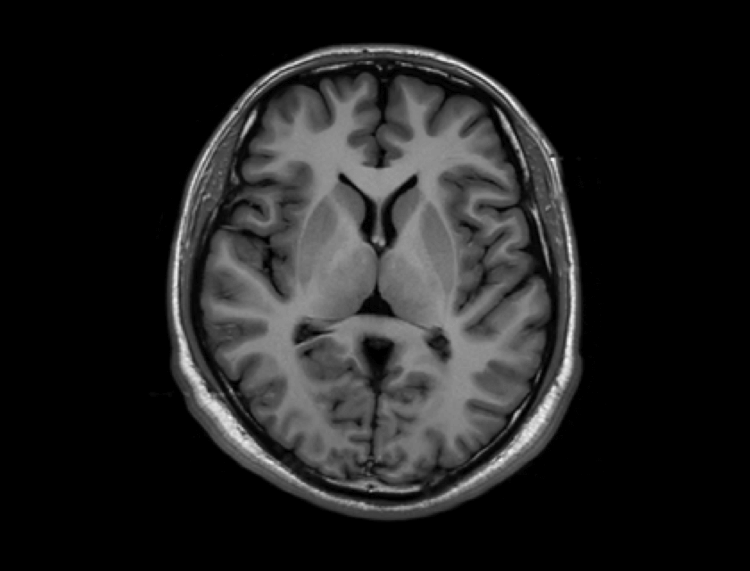 imaging of human brain's neuro