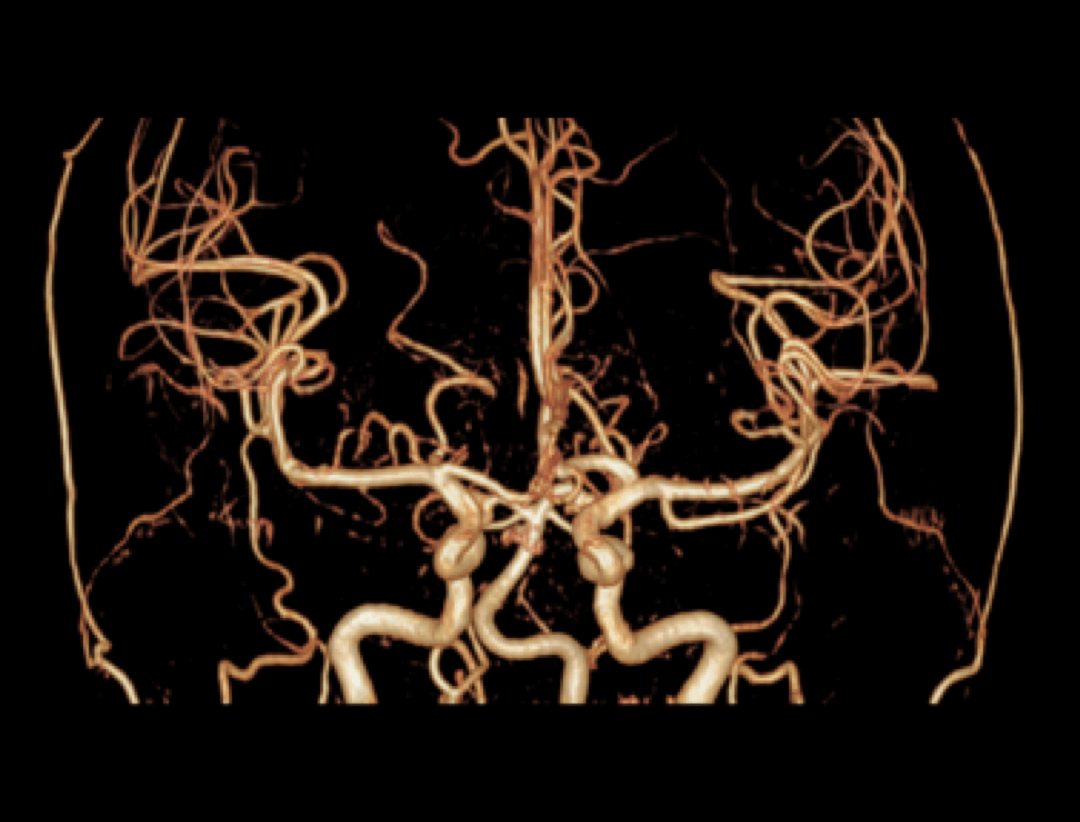 NCE-MRA imaging