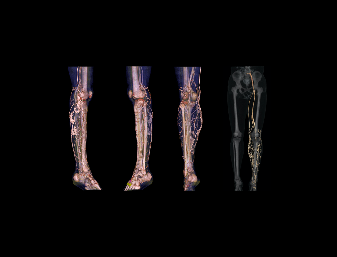  Varicosity imaging