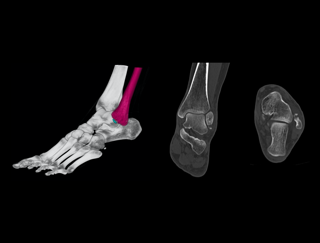 foot Injury imaging